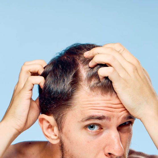man examining his hair stock image