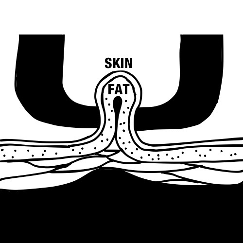 body fat calipers skin pinch calibre placement diagram