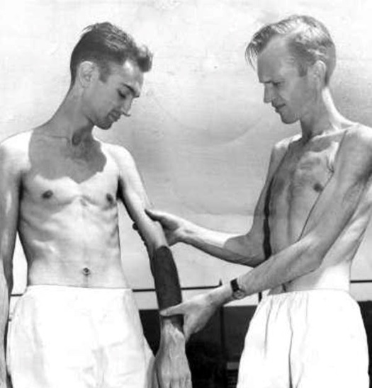 two starving men examining thin arm black and white